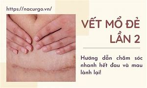 Đẻ Mổ Lần 2 Rạch Ở Đau